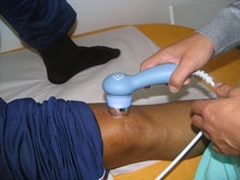 Ozonoterapie - Terapie cu ozon | Bucuresti | Clinica Picioarelor